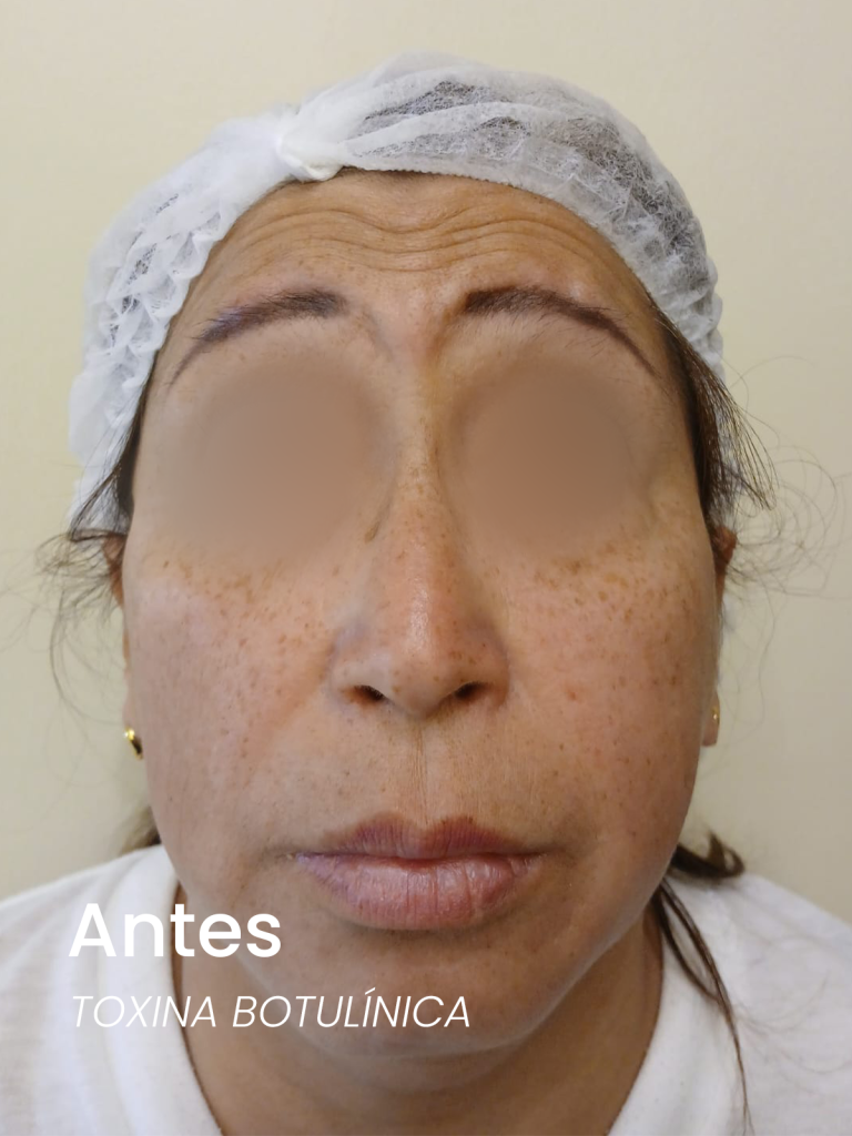 5antes
