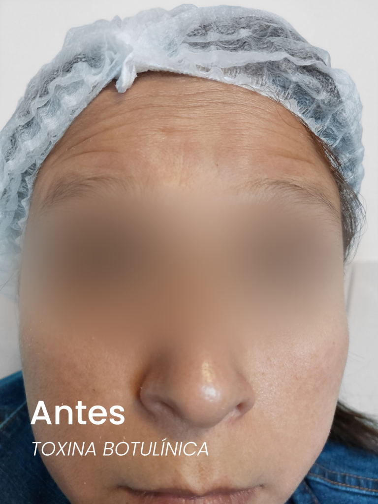 antes