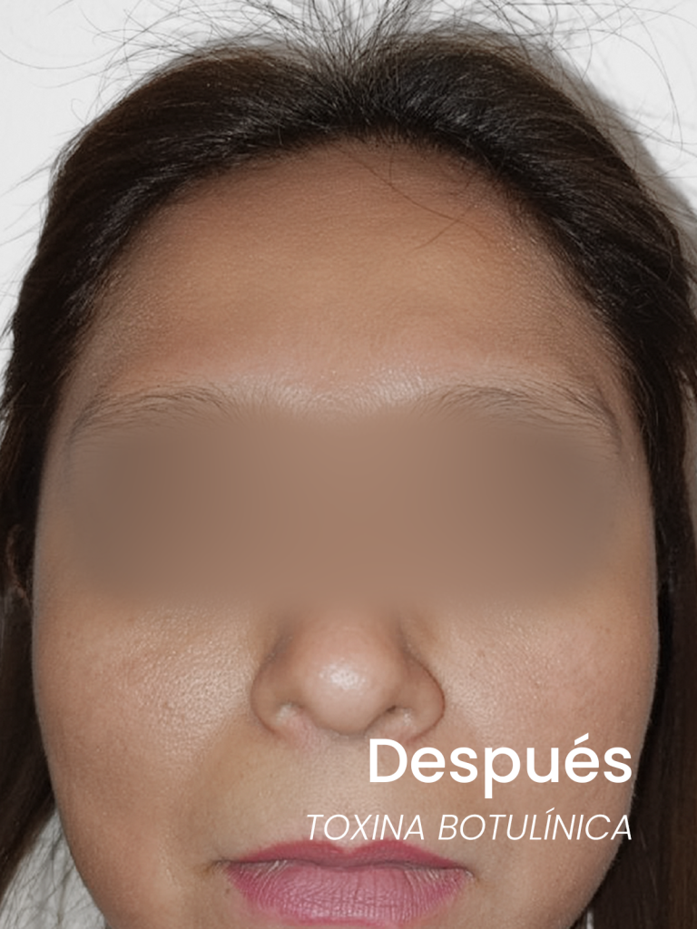 despues