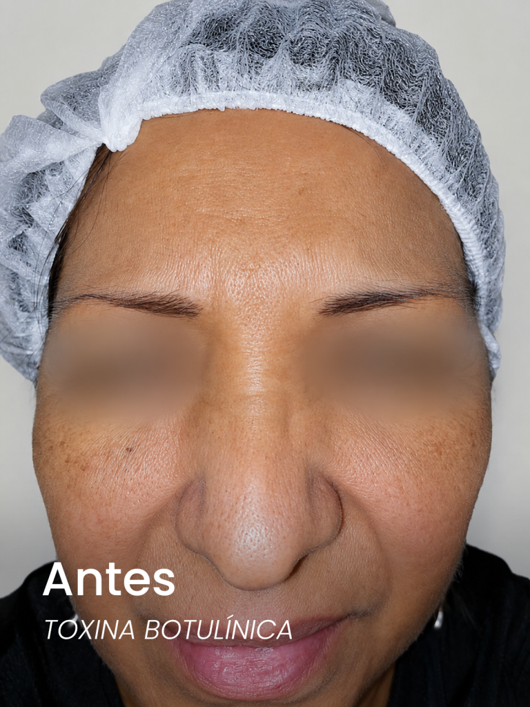 nuevo antes