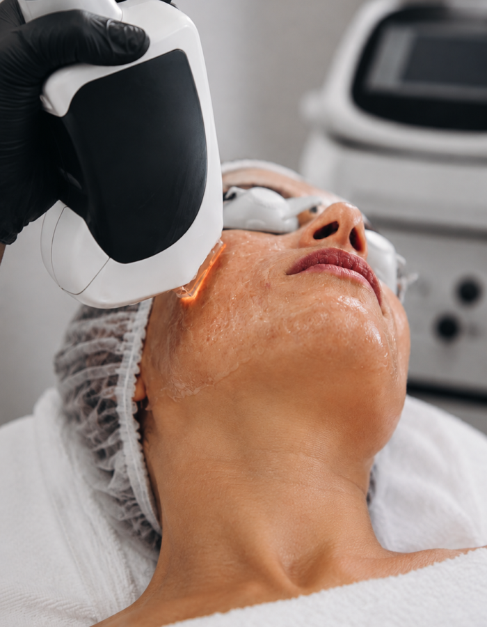IPL VASCULAR