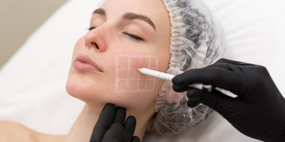 derma estética